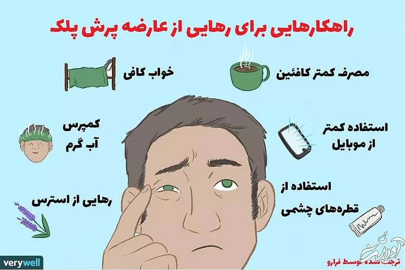 پرش پلک و هرآنچه که باید درباره آن بدانید درمان